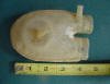 This is the left ventricle of a sac type artificial heart. It was invented by Dr. Akutsu at the Cleveland Clinic under the direction of Dr. Kolff.